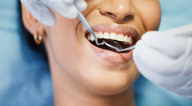 Best Emergency Tooth Extraction in Chambersburg, PA